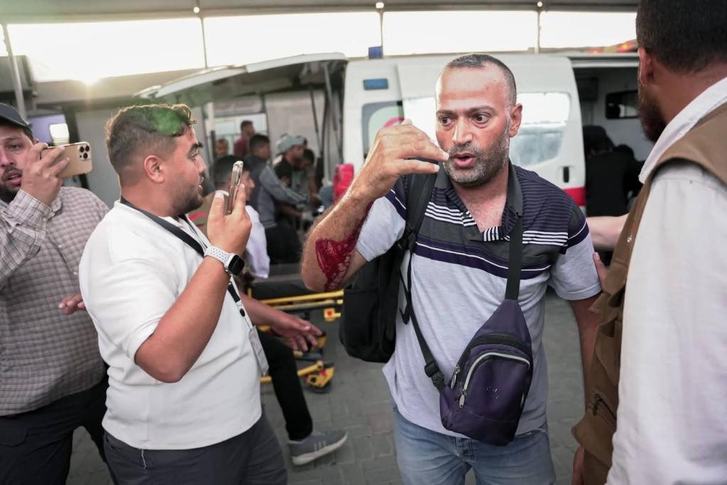 Mohammad Al-Khatib shows his wounded arm after being hit by an Israeli drone strike.