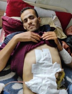 Freelance journalist Ramadan Abu Sakran recovers from injuries sustained in January 2024.
