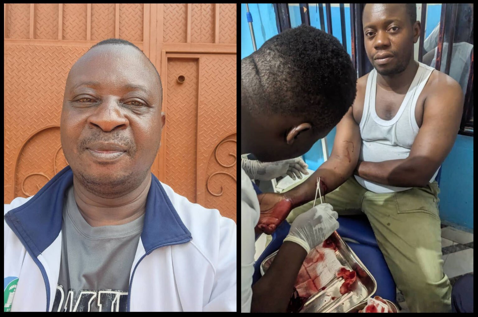 In eastern DRC, journalist faces knife attack, threats, another detained 3 times