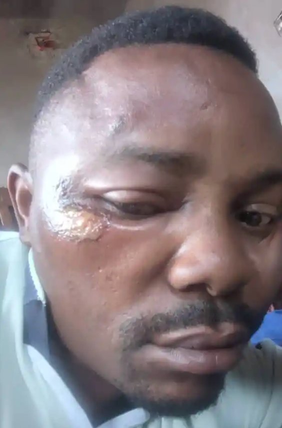 Self-portrait by Congolese journalist Prince Cikala Mihigo