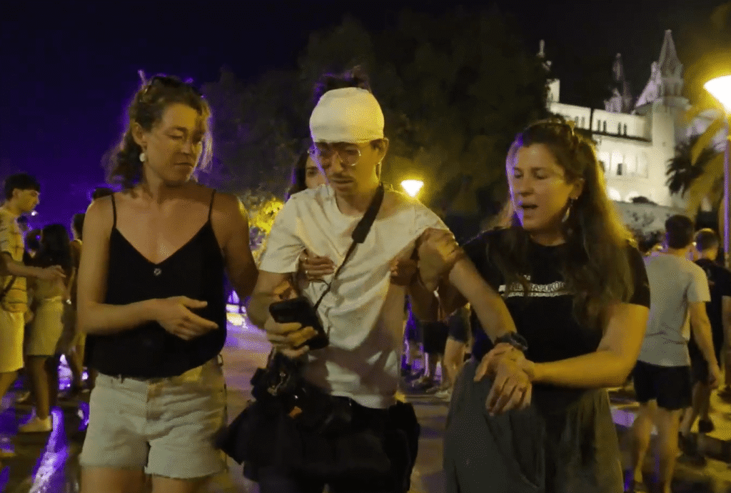 Photojournalist injured by police while covering protest in Spain’s Mallorca