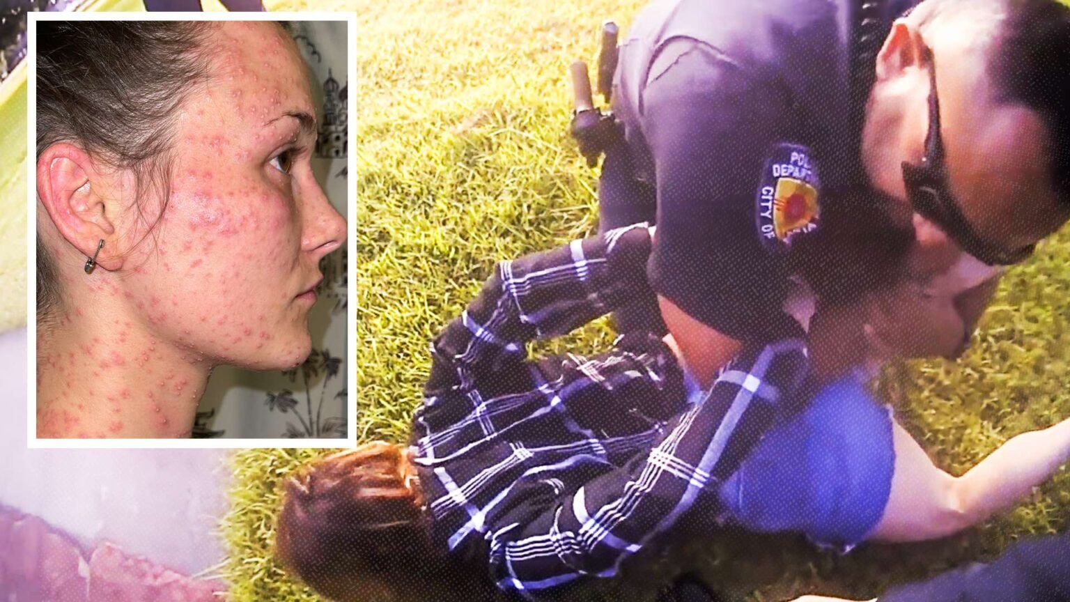 Appeals Court Grants Immunity to Texas Cops Who Held Handcuffed Woman Face Down in a Fire Ant Hill Appeals Court Grants Immunity to Texas Cops Who Held Handcuffed Woman Face Down in a Fire Ant Hill
